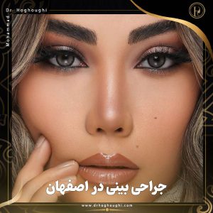 جراحی بینی در اصفهان + دکتر محمد حقوقی